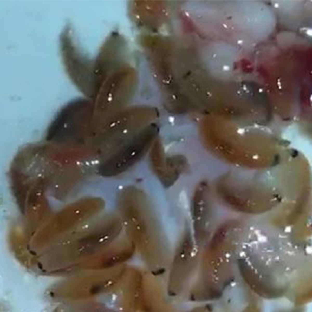 Did an Australian Teen Get Attacked by Flesh-Eating Sea Bugs?