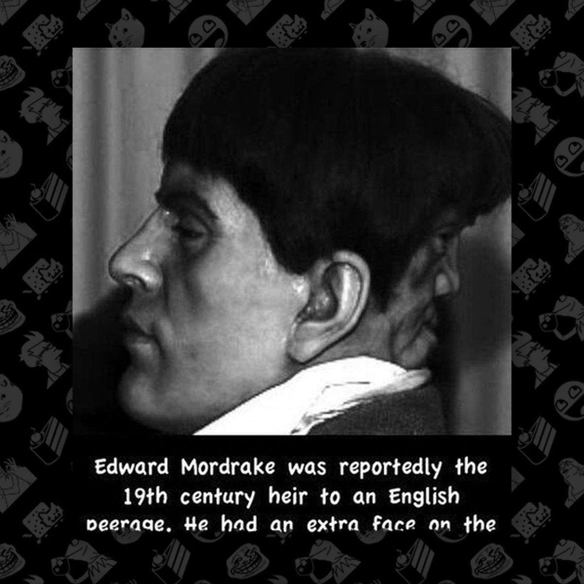 Edward Mordrake, the Man with Two Faces