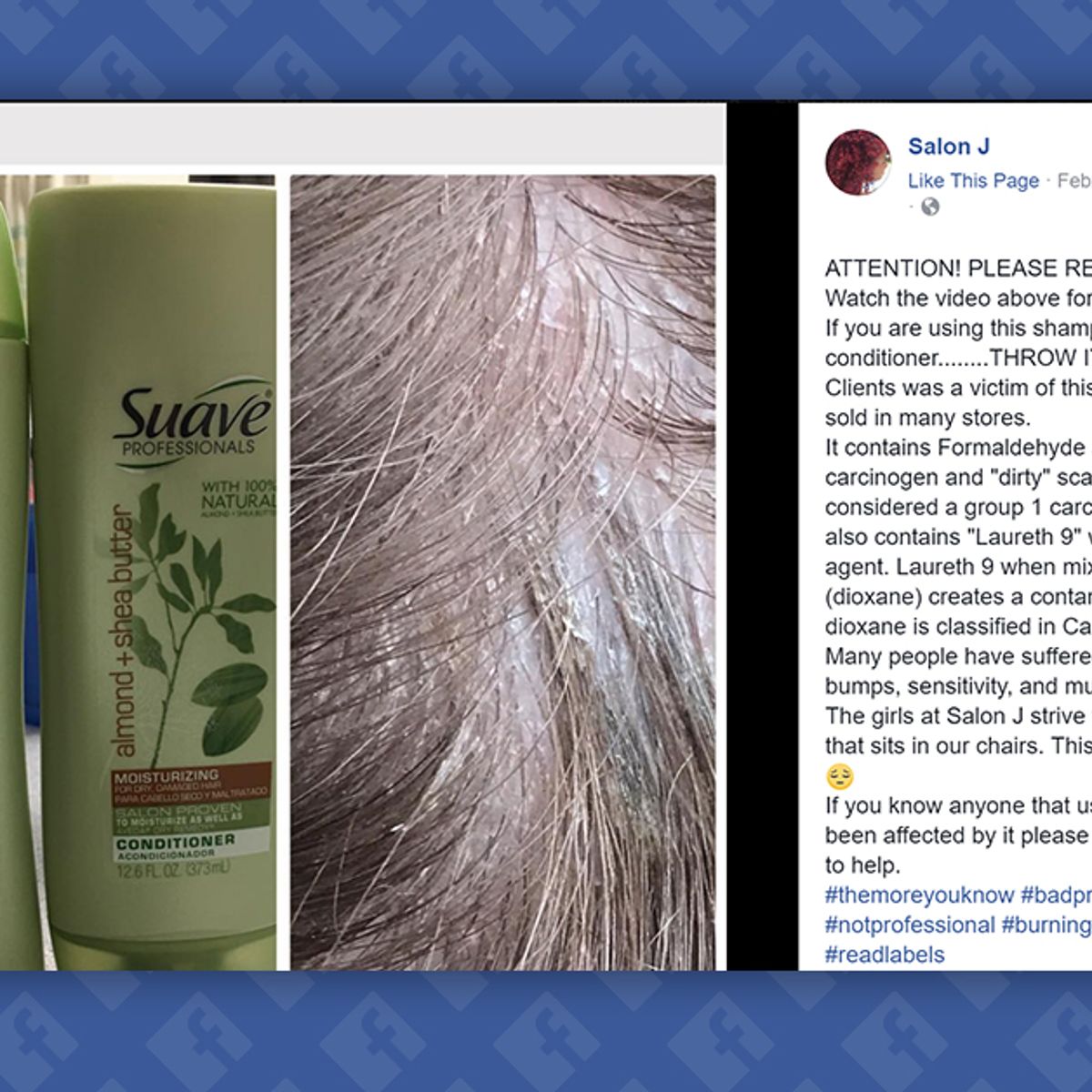 Does Suave Shampoo Contain an Ingredient That Causes Hair Loss? 