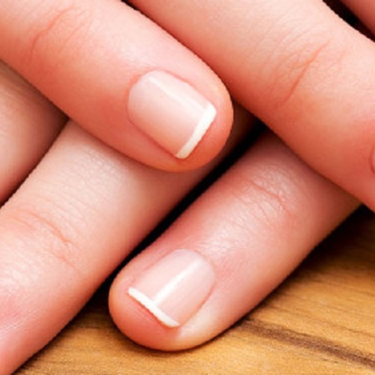 Clubbed Nails clubbed-nails