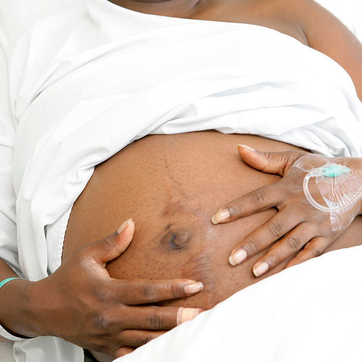 Did Louis XIV's Birth Fetish Change Modern Obstetrics? | Snopes.com