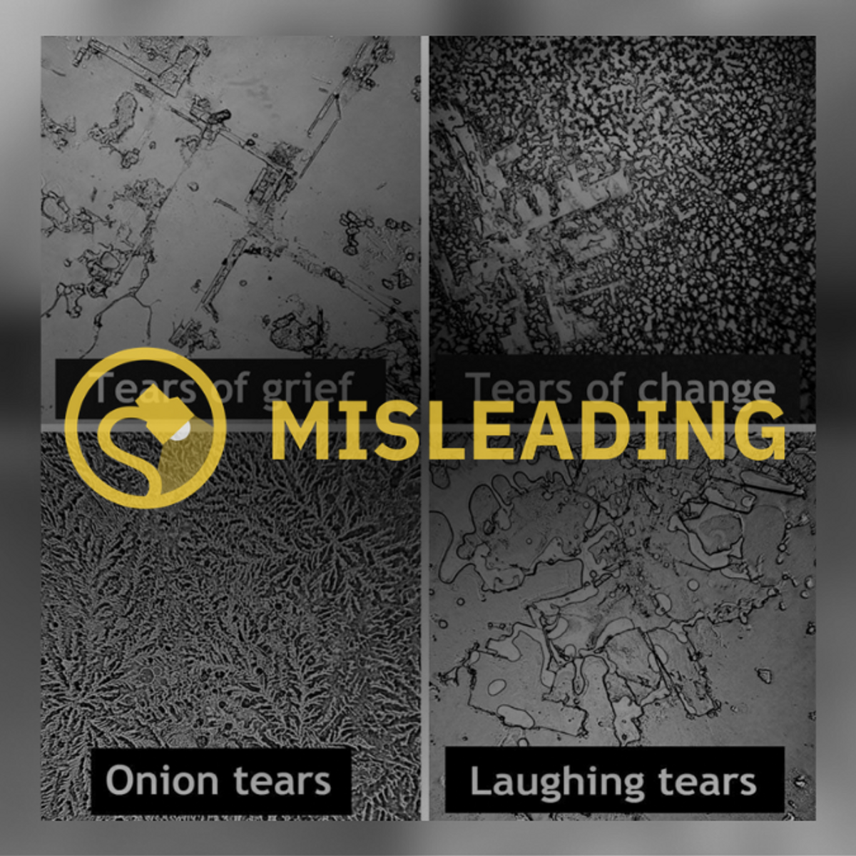 What Are Tears Made Of and Why Do We Cry?​