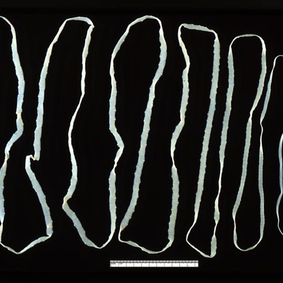 Tapeworm Diet Pills | Snopes.com