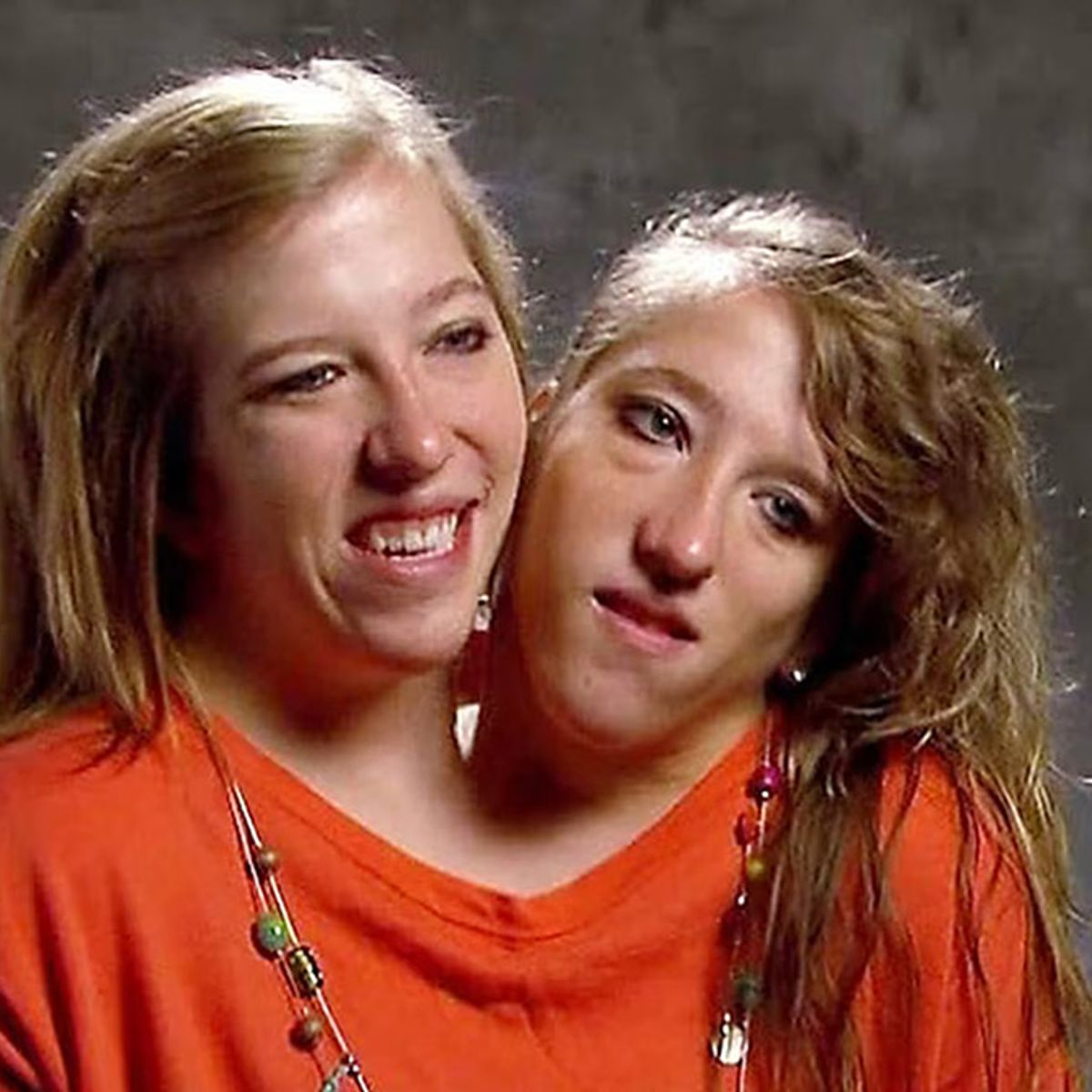 Conjoined Twins Abby and Brittany Hensel Posted Details About Their Sex  Lives? | Snopes.com