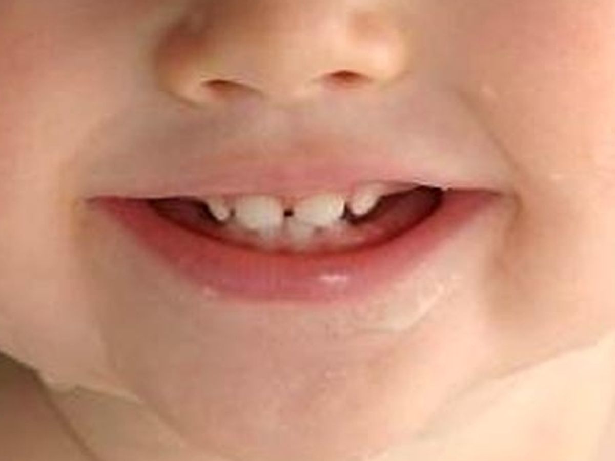 saving baby teeth for stem cells