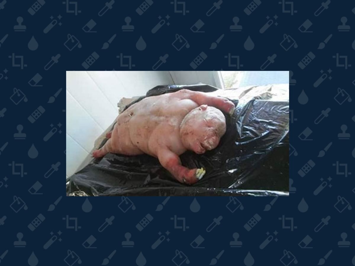 Was a Human-Lamb Hybrid Born in South Africa? 