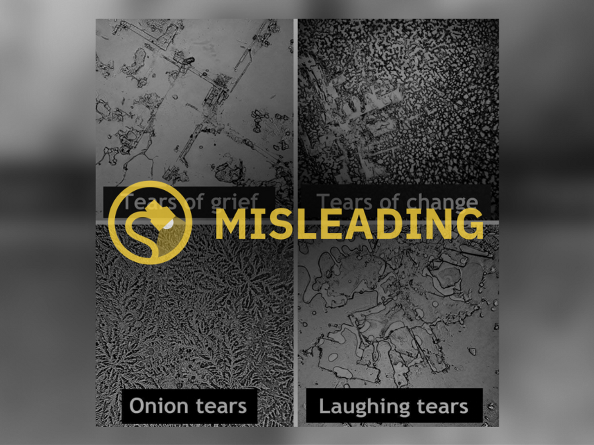 The Microscopic Structures of Dried Human Tears, Science