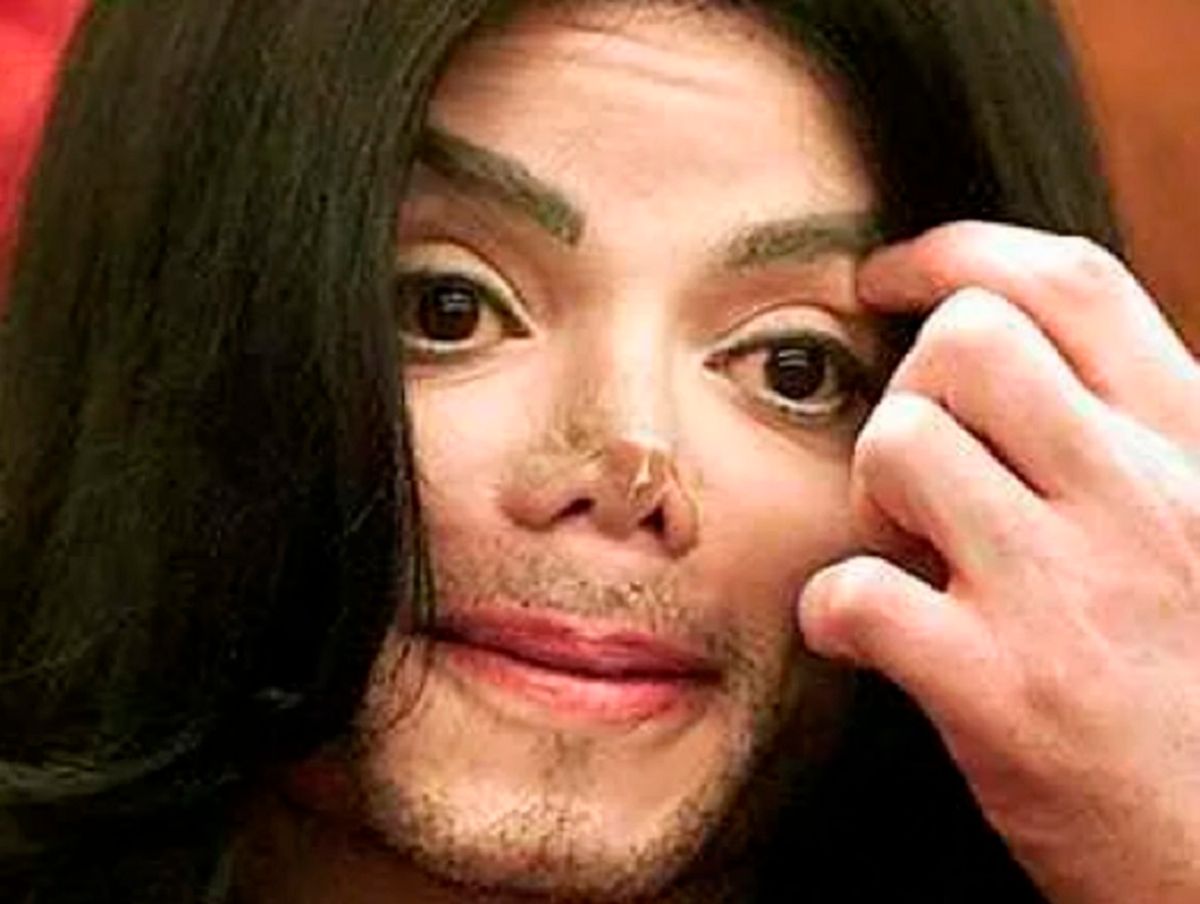 michael jackson before and after nose job