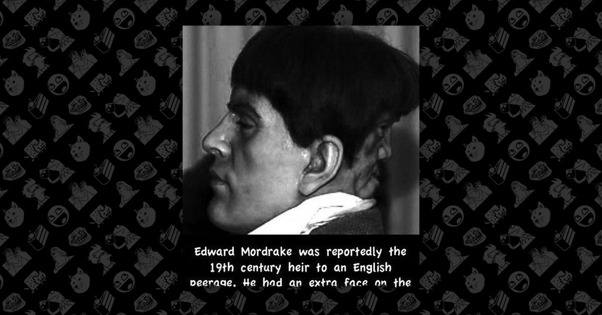 Edward Mordrake, the Man with Two Faces
