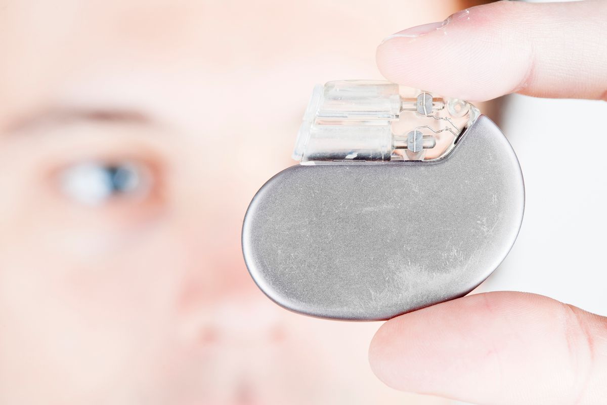 A male person, checking a cardiac pacemaker. XXL size image. ( Jan Otto / Getty Images)