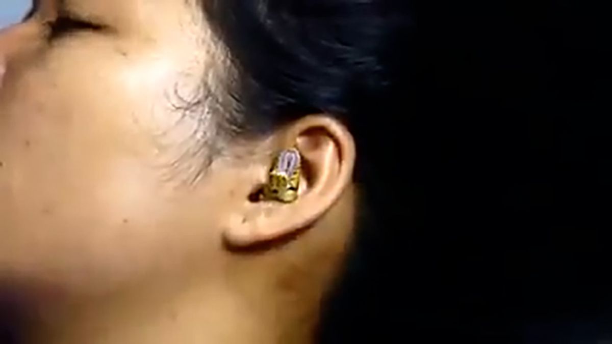 A Facebook video posted by a user supposedly from India claimed to show a snake in a woman's ear. (Facebook)