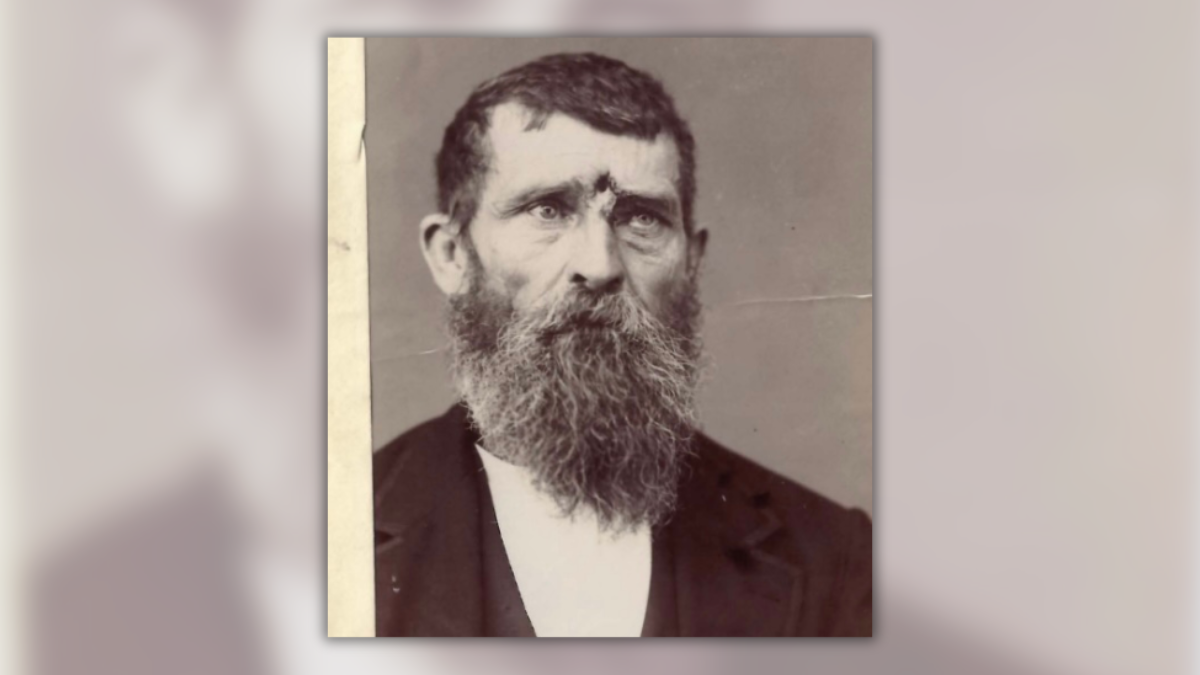 Civil War Veteran Survived Decades After Being Shot in the Forehead ...