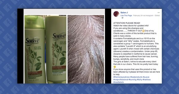 does-suave-shampoo-contain-an-ingredient-that-causes-hair-loss