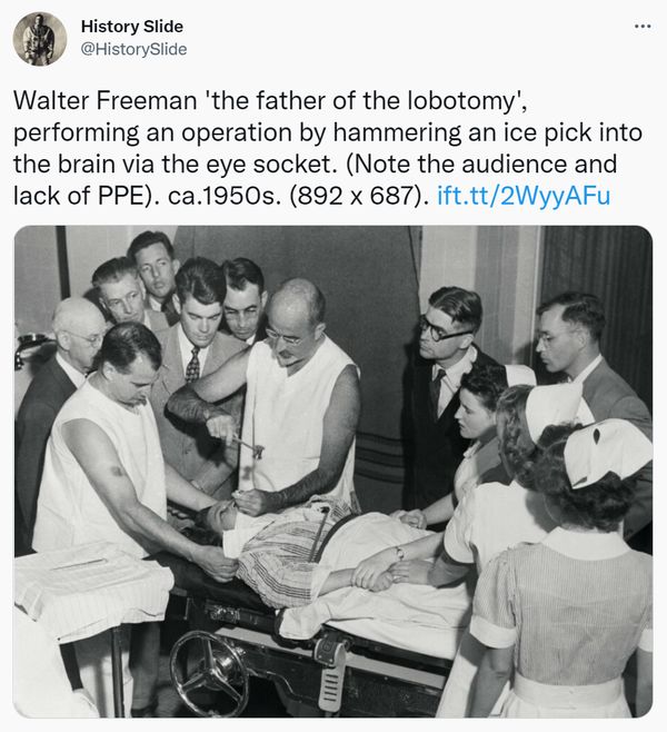 Were Lobotomies Performed with Ice Picks in the 1950s? – ReportWire