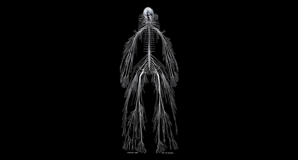 Does This Picture Show a Fully Dissected Human Nervous System? | Snopes.com