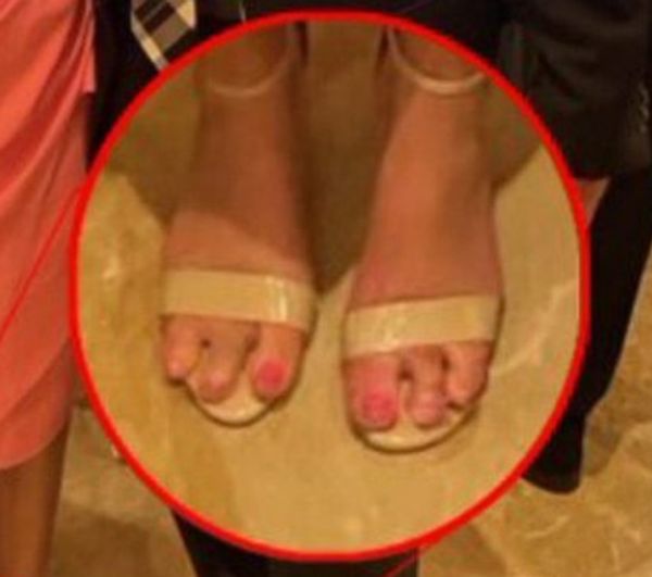 photo appears to show marjorie taylor green with only three toes on each foot